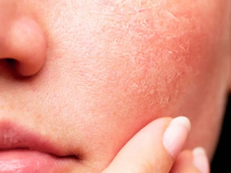 Tratamiento facial en curso en la cabina de la clínica